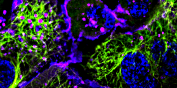 tub gfp bioimaging core picture